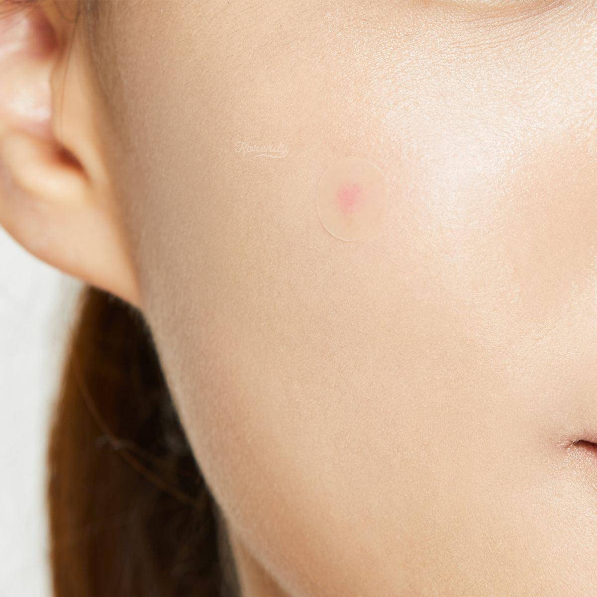 Cosrx - Acne Pimple Master Patch (Akne ve Sivilce Söndürücü Şeffaf Bant) 24'lü - Image 3