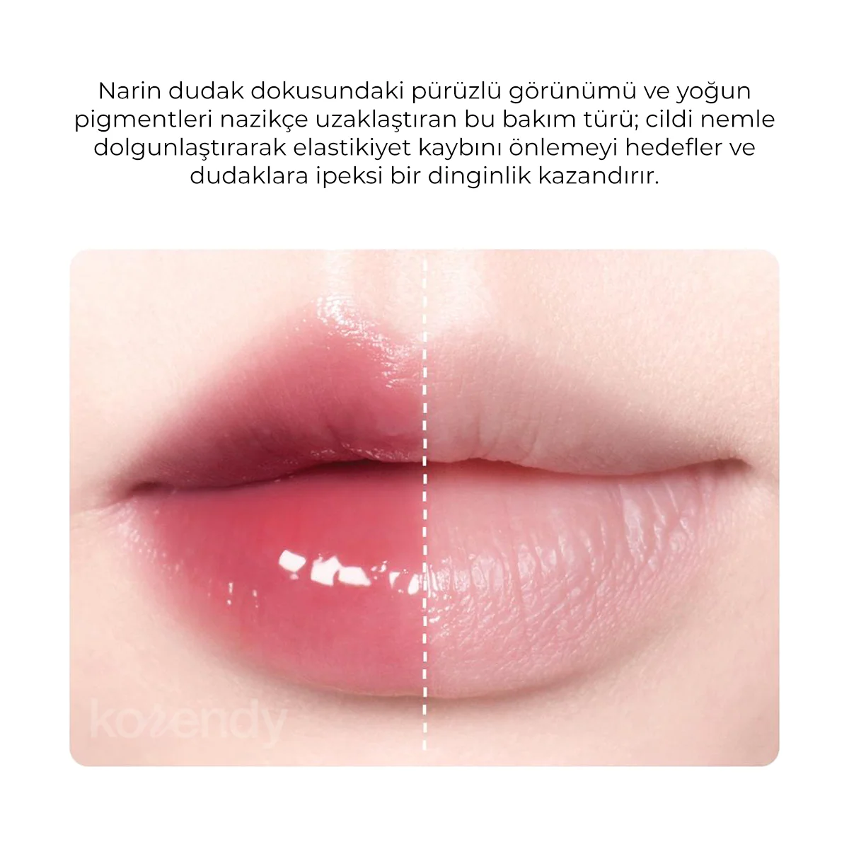 Amuse - Tint One Touch Remover (Tint ve Ruj Silen 6 Çeşit Peptitli Dudak Temizleyicisi) (%70 İndirimli) - Image 4