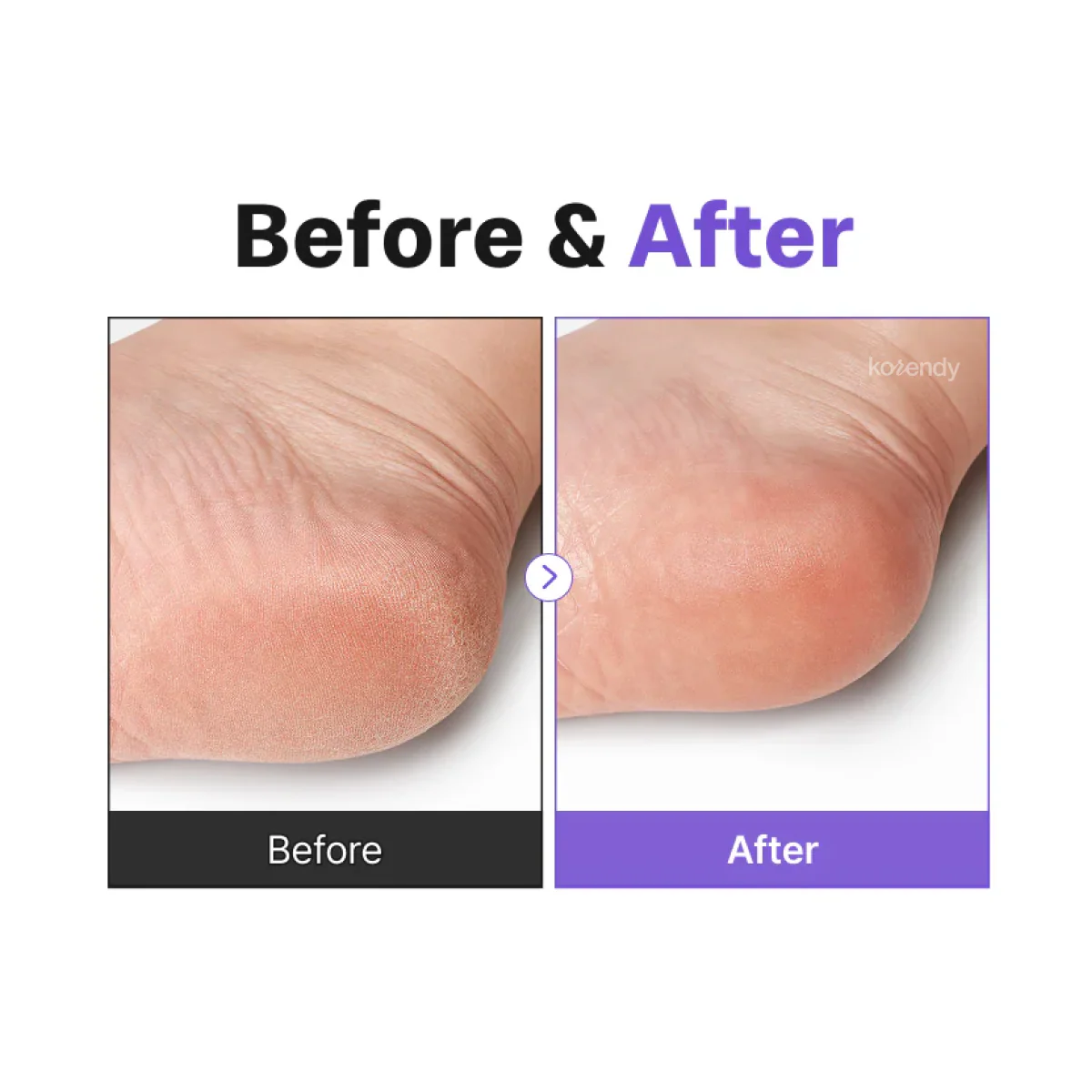 Baren - Centella Deep Soothing Ritual Foot Mask (Cica ve Üre İçeren SOS Hızlı Bakım Ayak Maskesi - Peeling Değildir) (%15-%30 Lansman İndirimi) - Image 4