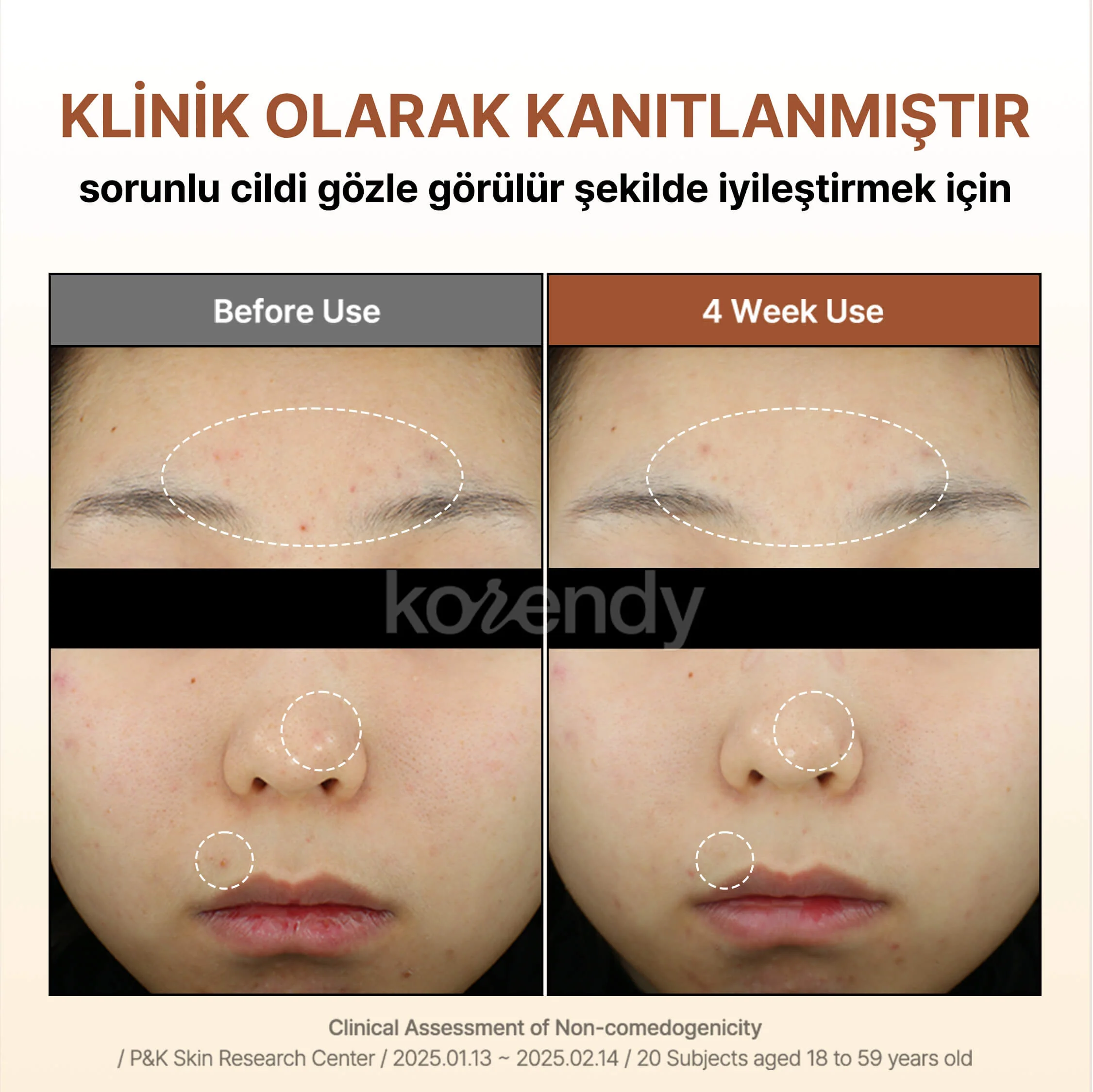 By Wishtrend - Mandelic Acid Gentle Exfoliating Toner (Pürüz ve Geniş Gözenek Önleyici Ölü Deri Arındırıcı Mandelik Asitli Peeling Toniği) - Image 10