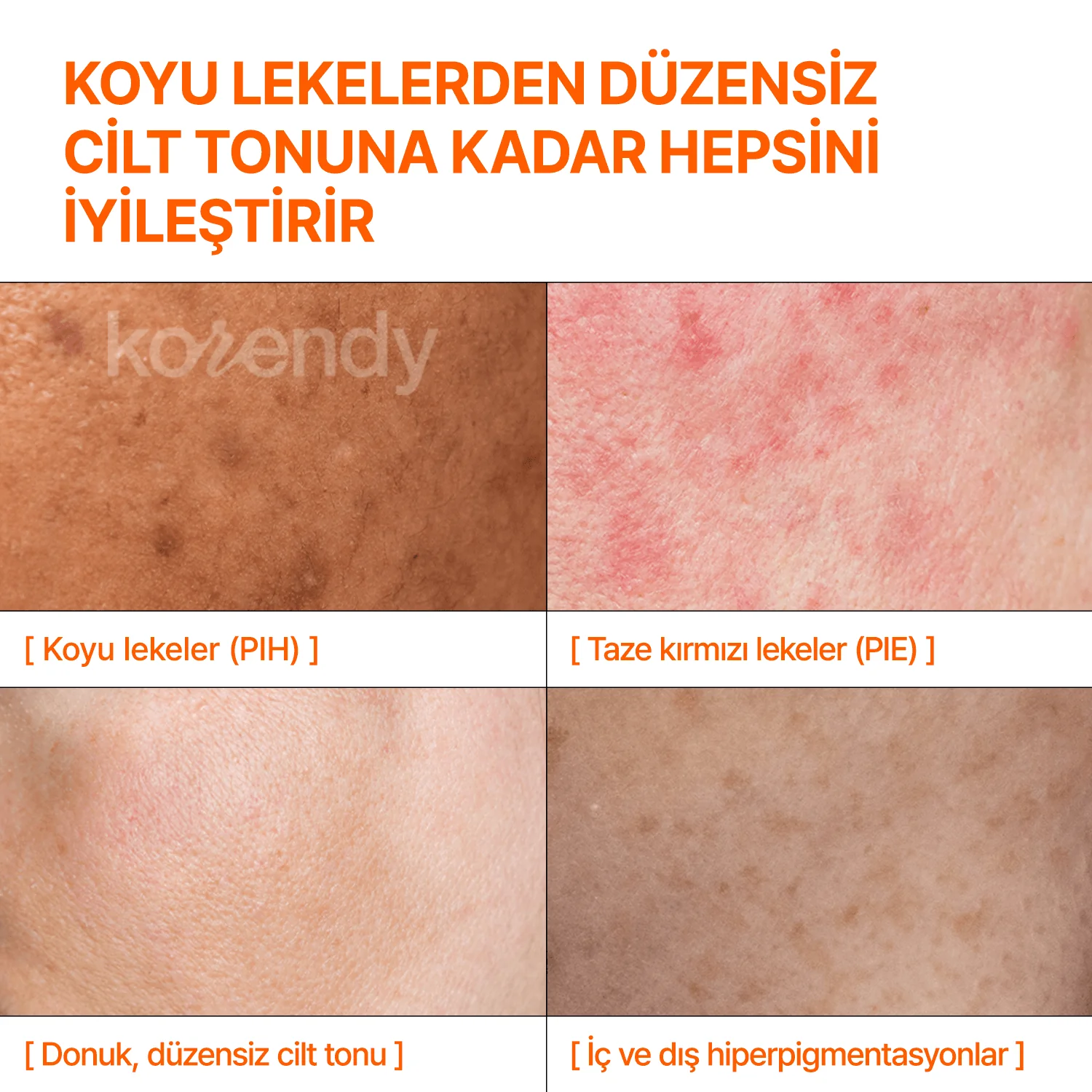 By Wishtrend  - Mandelic Acid Dark Spot Correcting Serum (Kırmızı, Kahverengi ve Sarı Leke Önleyici ve Parlatıcı Mandelik Asitli Serum) 30ml - Image 4