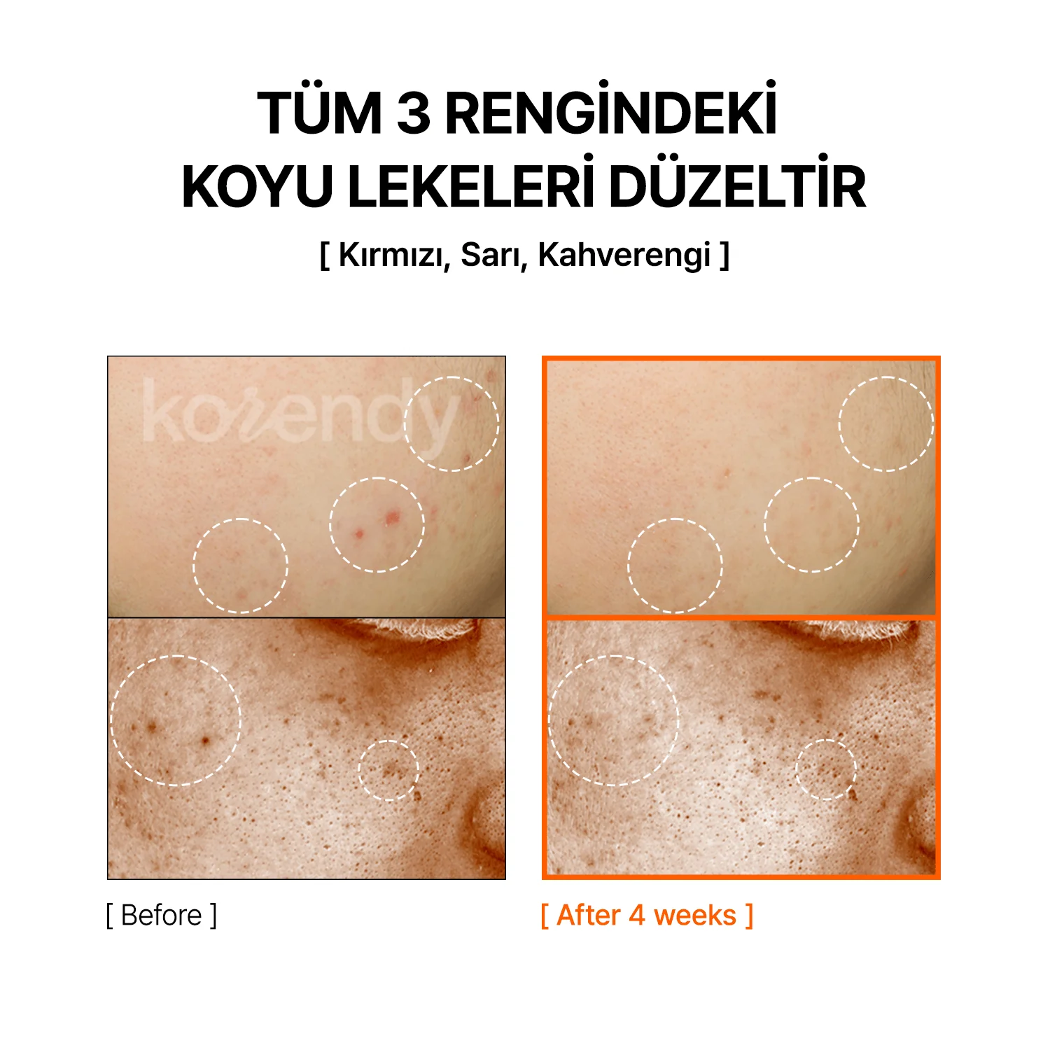 By Wishtrend  - Mandelic Acid Dark Spot Correcting Serum (Kırmızı, Kahverengi ve Sarı Leke Önleyici ve Parlatıcı Mandelik Asitli Serum) 30ml - Image 7
