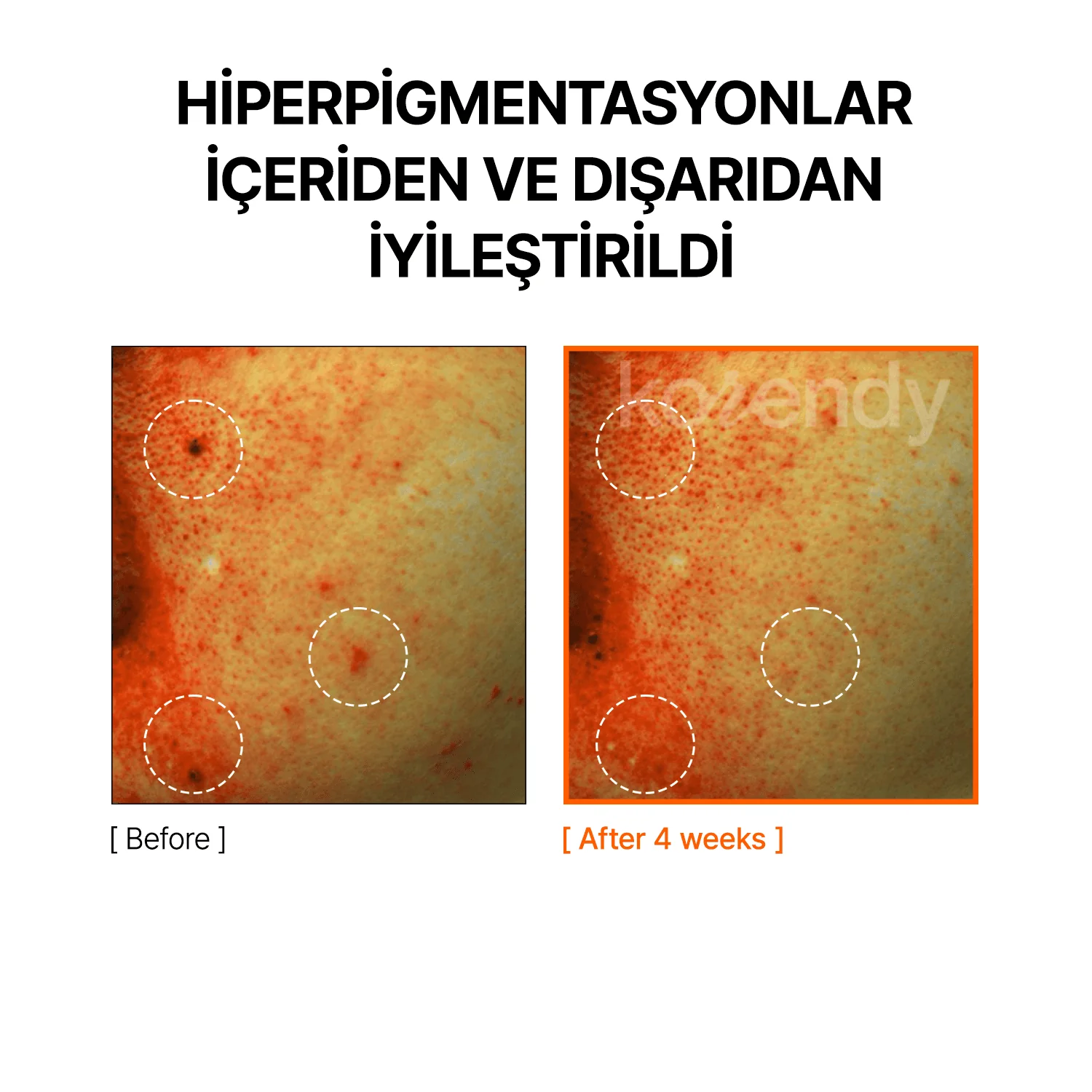 By Wishtrend  - Mandelic Acid Dark Spot Correcting Serum (Kırmızı, Kahverengi ve Sarı Leke Önleyici ve Parlatıcı Mandelik Asitli Serum) 30ml - Image 8