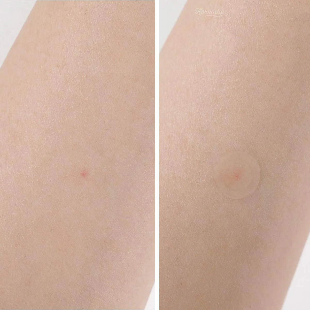 By Wishtrend - Sivilce Akne Bandı (Clear Skin Shield Acne Patch) 39'lu - Image 4