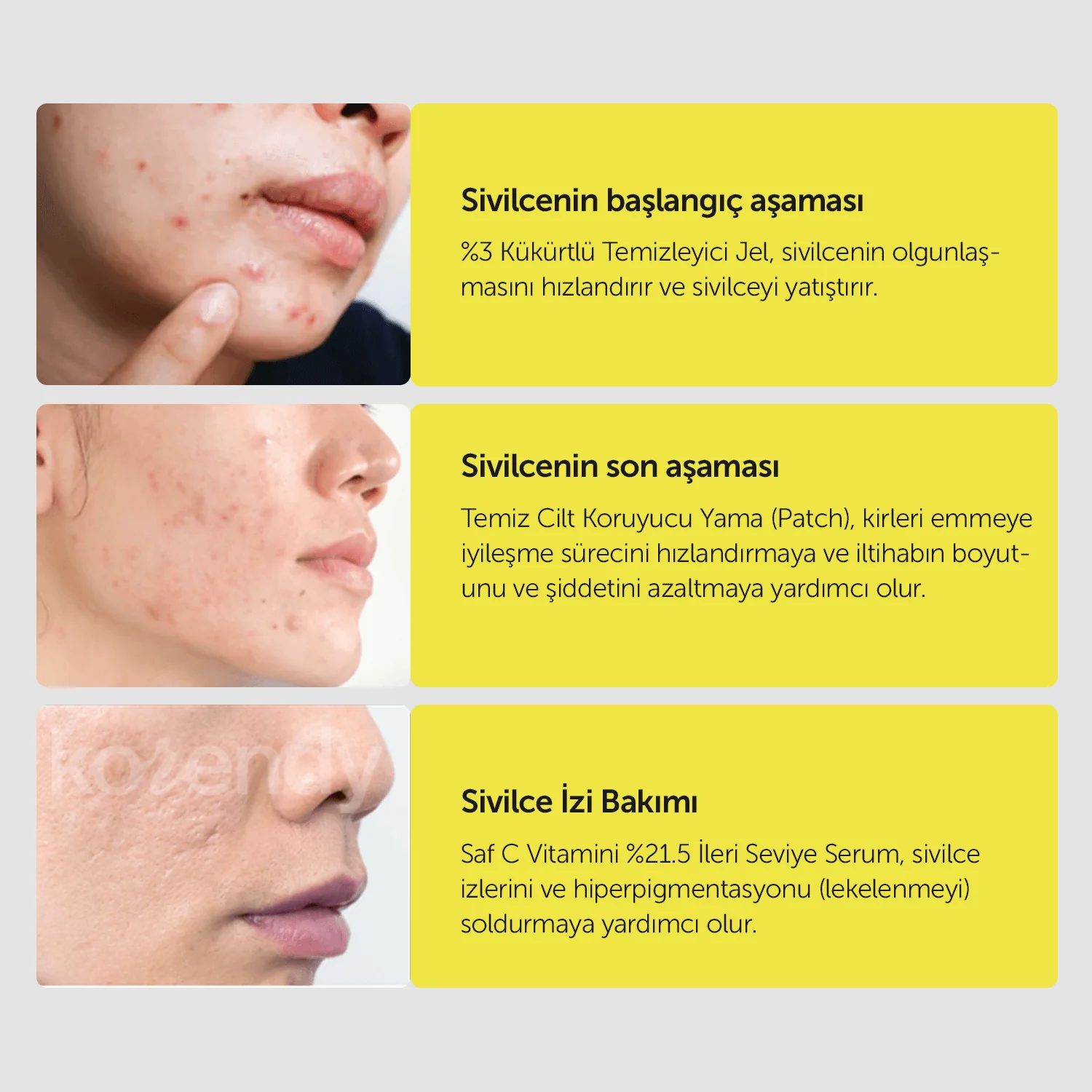 By Wishtrend - Sulfur 3% Clean Gel (Sivilce Kremi) - Image 11