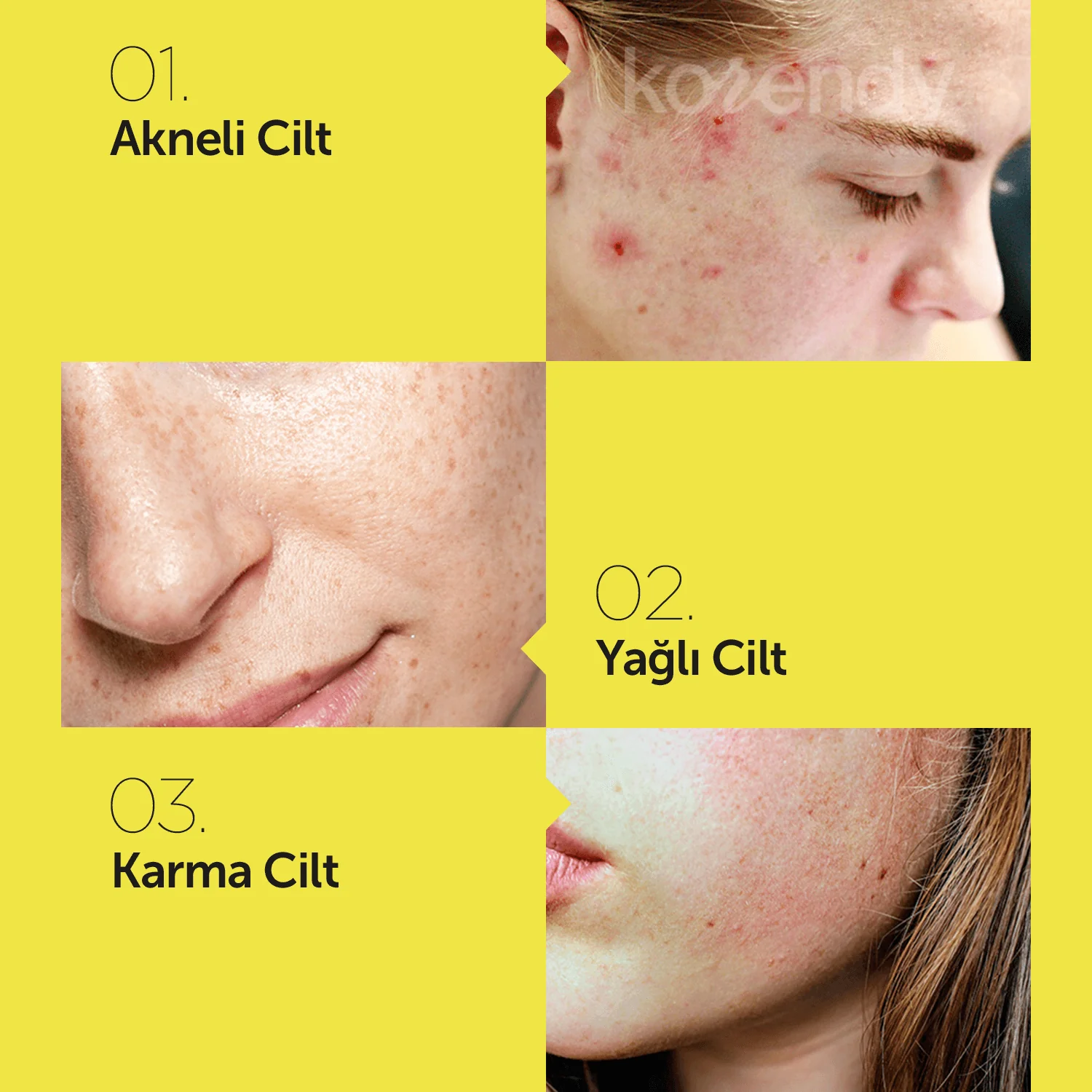 By Wishtrend - Sulfur 3% Clean Gel (Sivilce Kremi) - Image 3