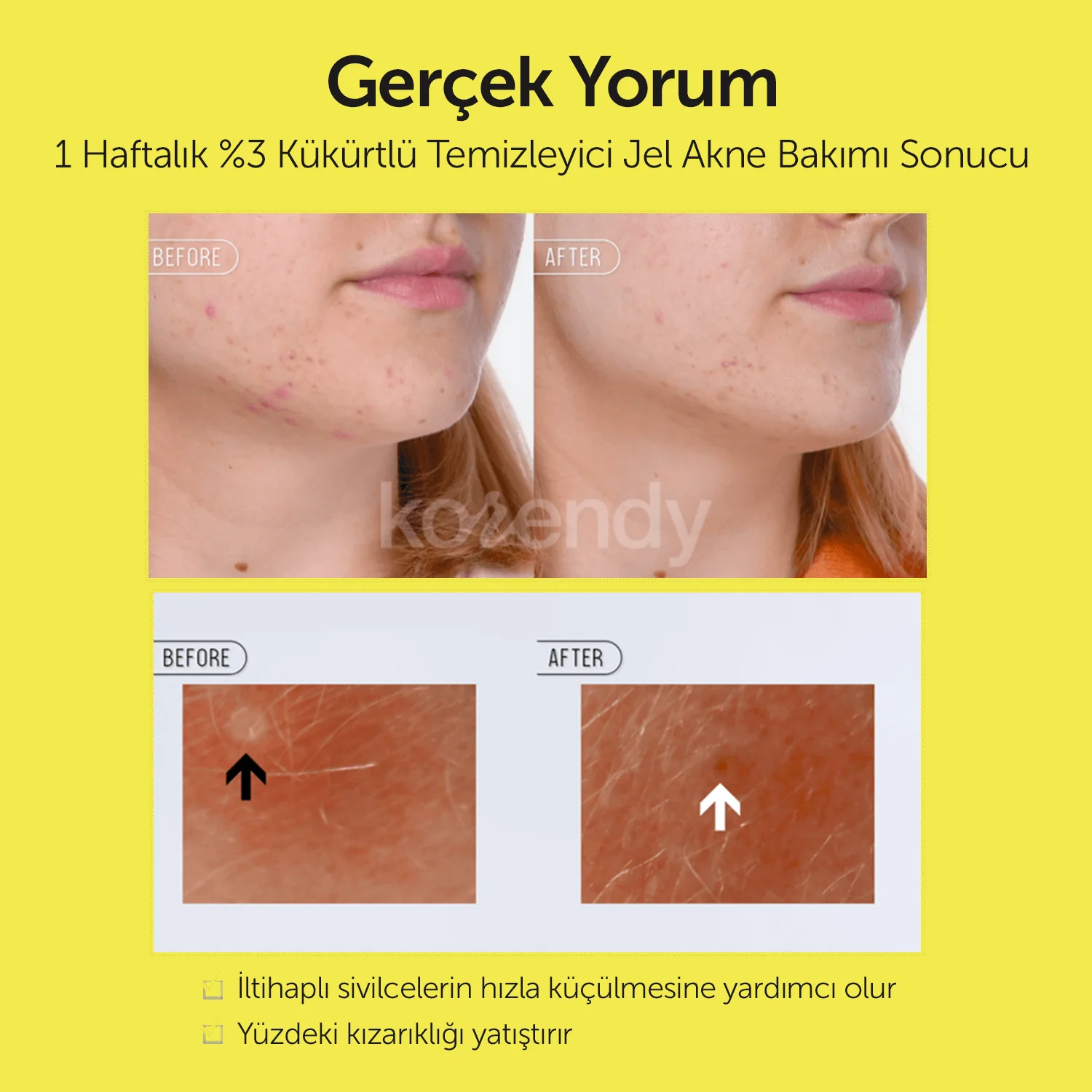 By Wishtrend - Sulfur 3% Clean Gel (Sivilce Kremi) - Image 9