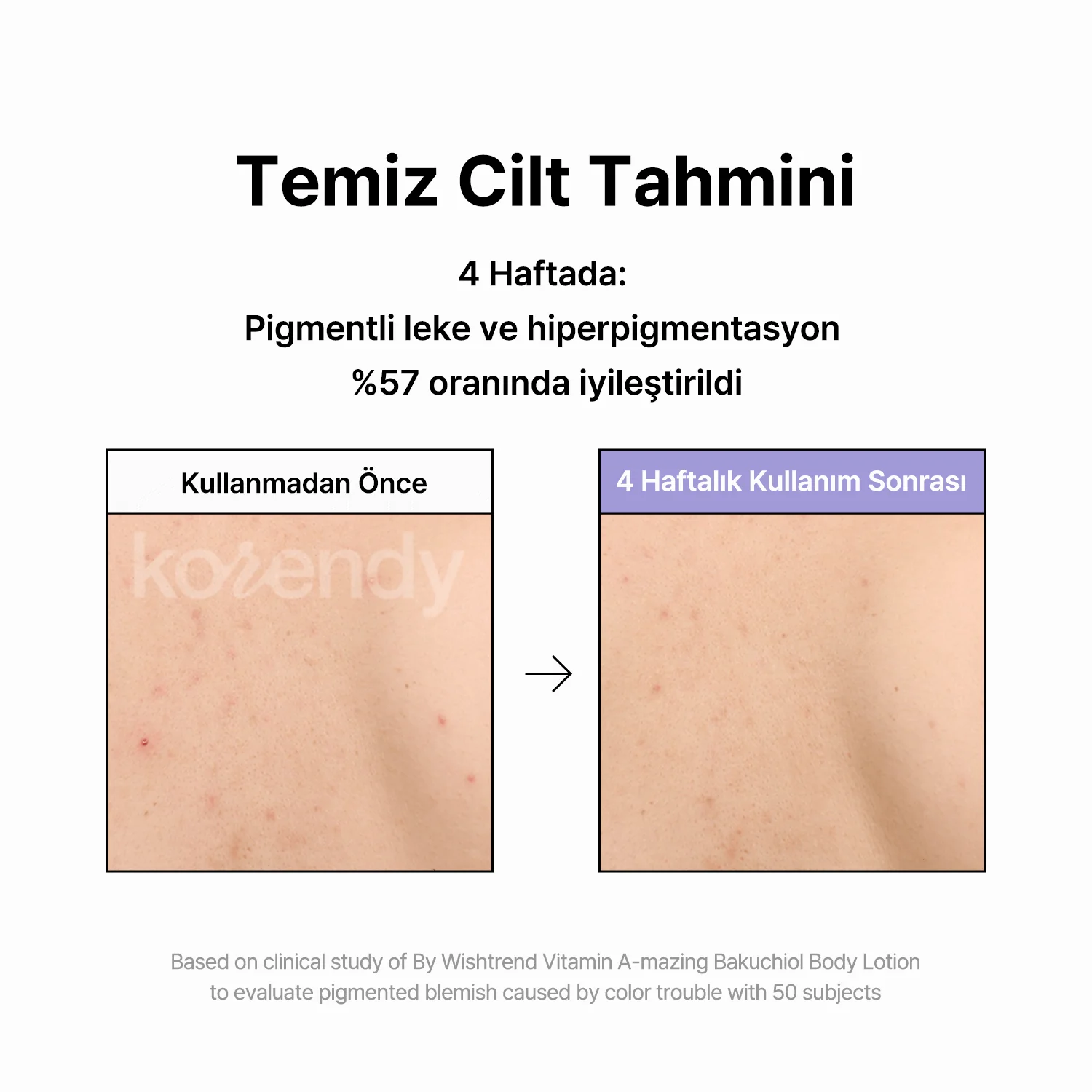 By Wishtrend - Vitamin A mazing Bakuchiol Body Lotion (Pürüz Karşıtı Gözenek Arındırıcı Bakuchiol Retinal Vücut Losyonu) 150gr - Image 10