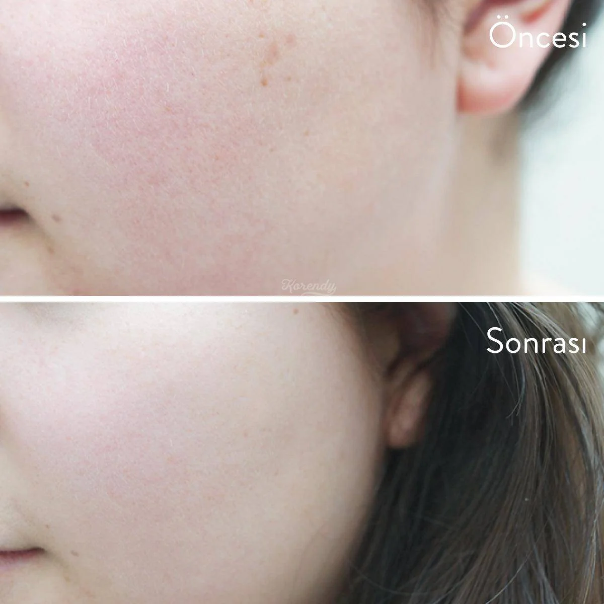 Cosrx - AHA/BHA Clarifying Treatment Toner 150ml - Image 3