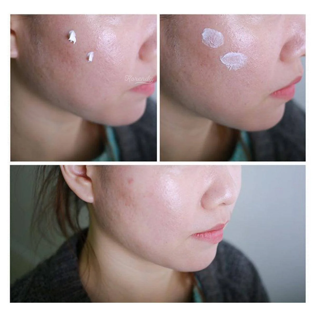 Cosrx - Centella Asiatica Blemish Cream 30ml - Image 4