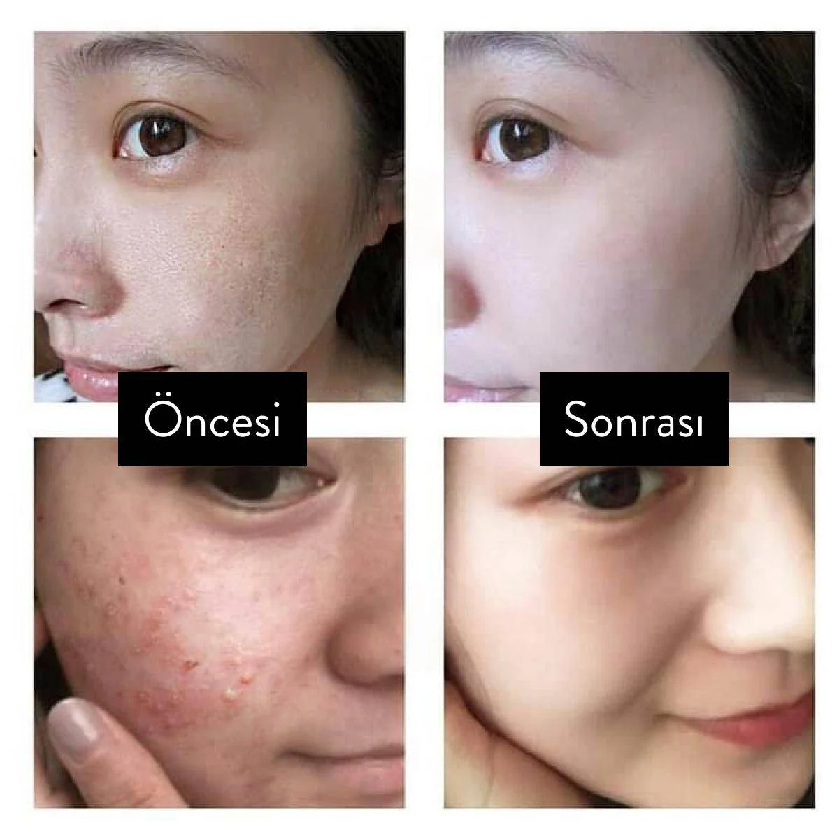 Cosrx - Hyaluronic Acid Intensive Cream 100ml - Image 4