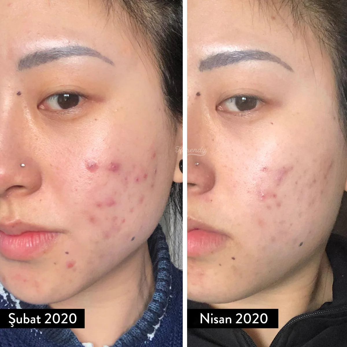 Cosrx - Salicylic Acid Daily Gentle Cleanser (Salisilik Asitli Geniş Gözenek Karşıtı Temizleyici Jel) 150ml - Image 3