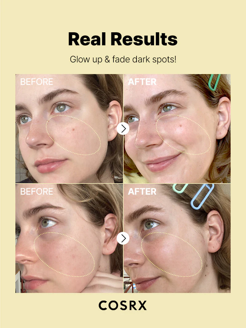 Cosrx - Vitamin C 23 Serum (Leke Karşıtı Vitamin C Serumu) 20g - Image 2