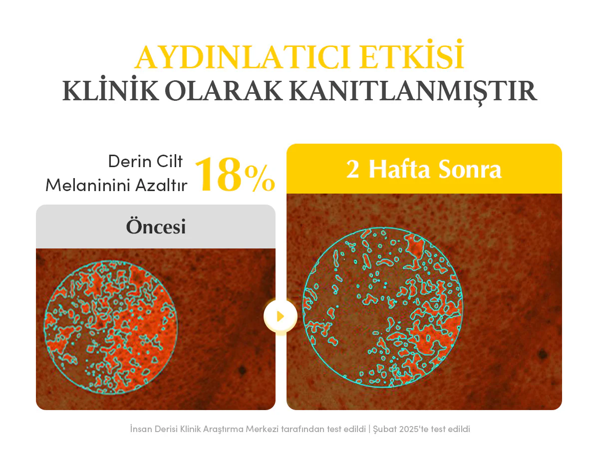 Eqqualberry - Collagen Glow up Hydrogel Mask (4'lü) (Leke Önleyici ve Parlatıcı Kolajenli ve Glutatyonlu Şeffaflaşan Maske) - Image 9