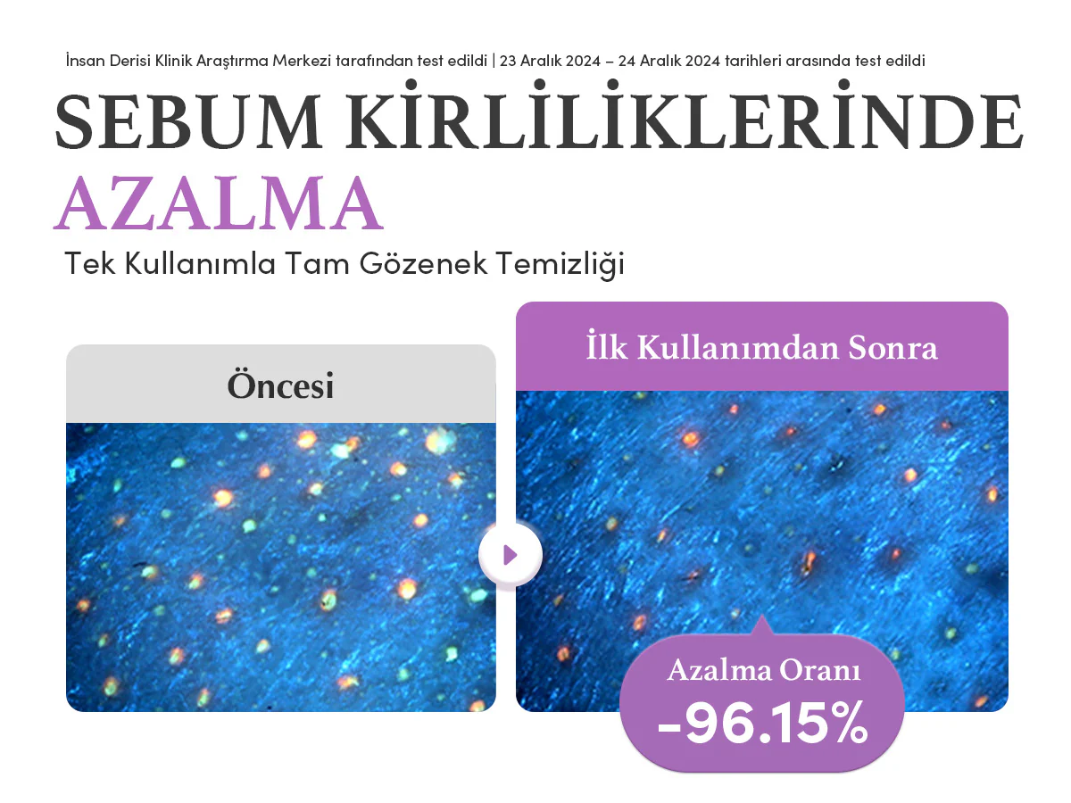 Eqqualberry - Purple Rice Pore Purifying Pack Cleanser (Geniş Gözenek Önleyici ve Ölü Deri Arındırıcı Mor Pirinçli Temizleyici) 130gr - Image 12