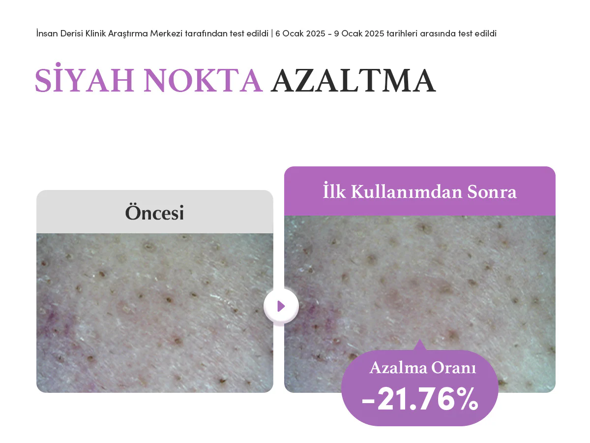 Eqqualberry - Purple Rice Pore Smoothing Cleansing Oil (Siyah Nokta Önleyici Gözenek Arındırıcı Mor Pirinçli Temizleyici Yağ) 200ml - Image 4