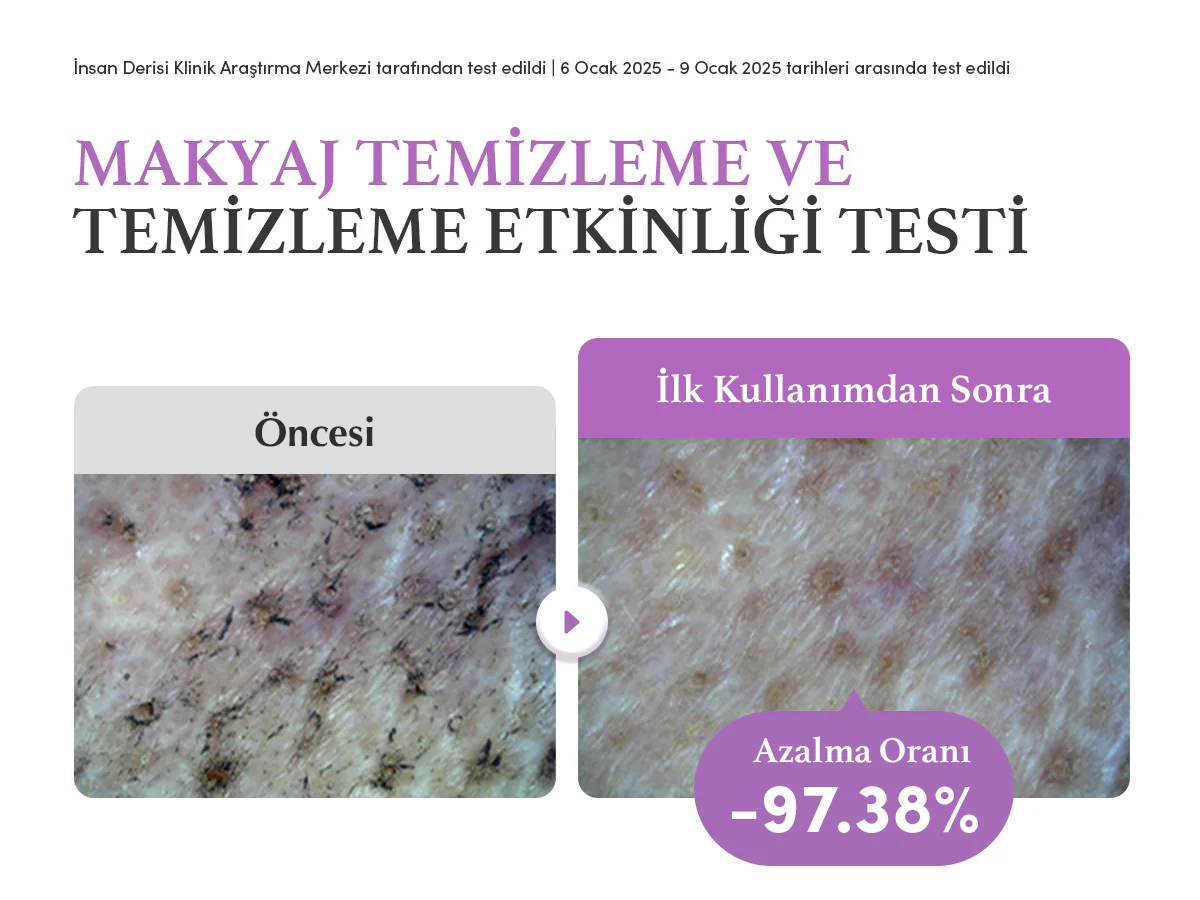 Eqqualberry - Purple Rice Pore Smoothing Cleansing Oil (Siyah Nokta Önleyici Gözenek Arındırıcı Mor Pirinçli Temizleyici Yağ) 200ml - Image 5
