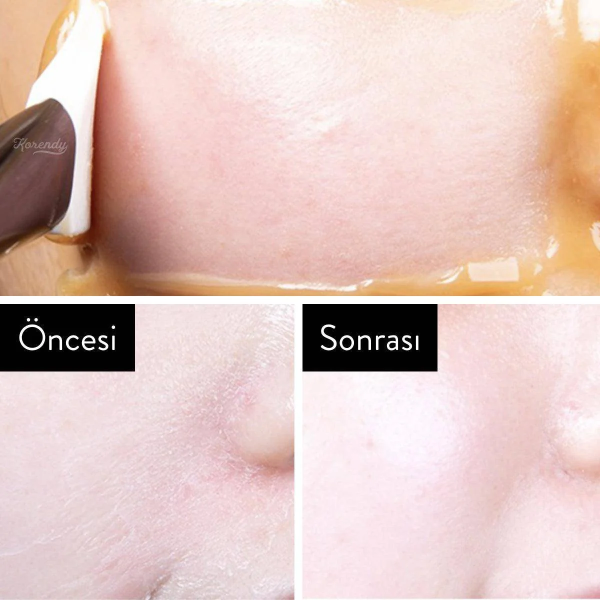 I'm From - Honey Mask (Besleyici Elastikiyet Koruyucu %38 Organik Bal Maskesi) - Image 6