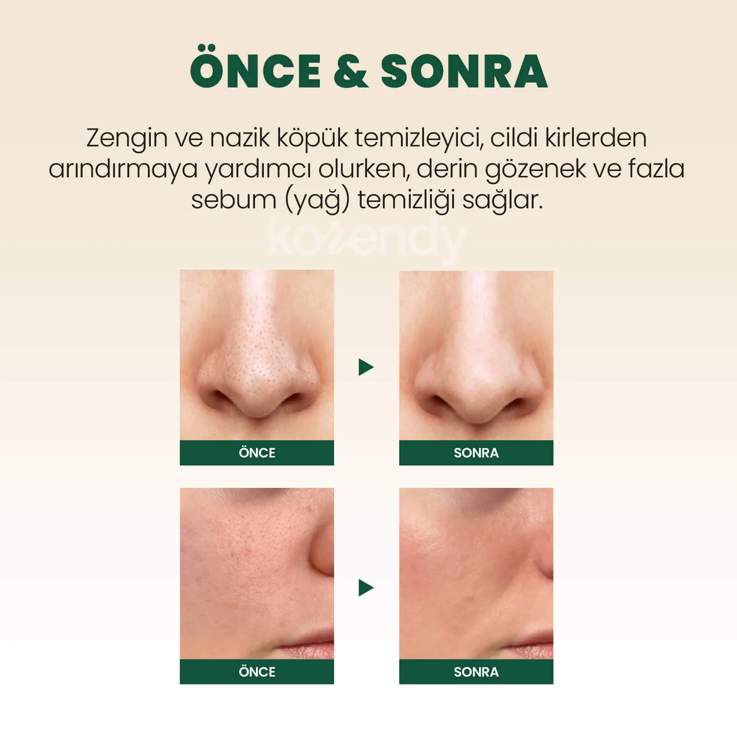 K-Secret - SEOUL 1988 Cleansing Foam Pine Cica 1% + Probiotics  (Siyah & Beyaz Nokta Önleyici ve Stres Karşıtı Çam Cica Özlü Köpük Temizleyici) 150ml - Image 5