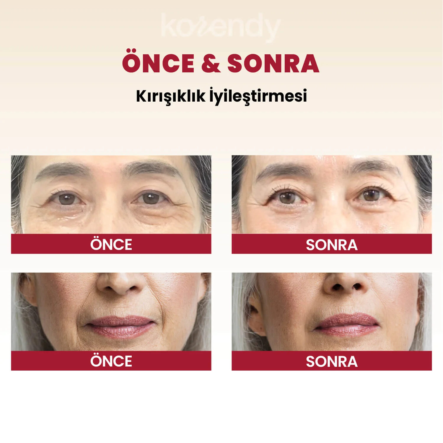 K-Secret - SEOUL 1988 Cream Retinal Liposome 1% + Fermented Rice (Kırışıklık & Leke Önleyici Pürüz Engelleyici %1 Retinalli Pirinç Fermentli Krem) 50ml - Image 5