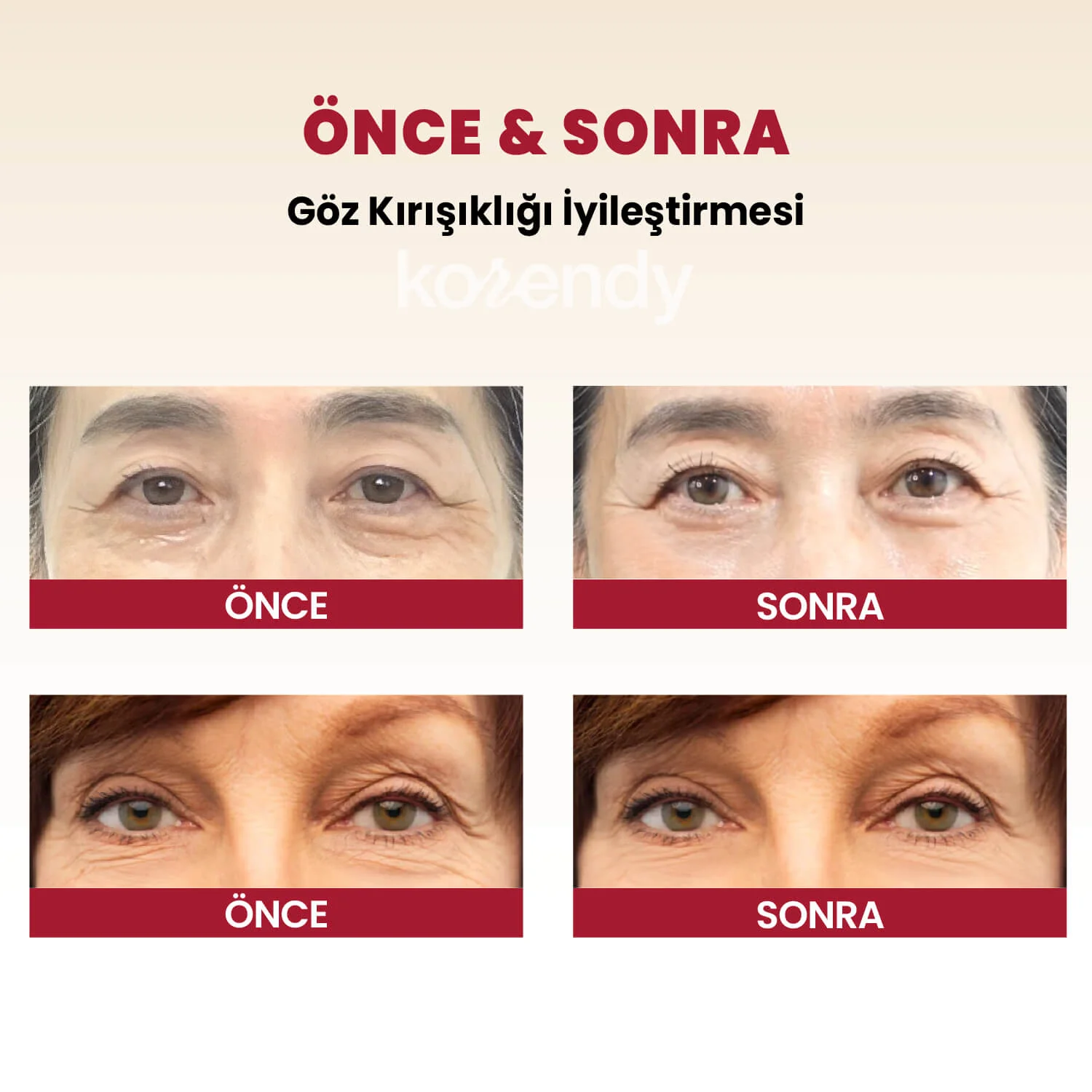 K-Secret - SEOUL 1988 Eye Cream Retinal Liposome 4% + Fermented Bean (İnce Çizgi Önleyici ve Elastikiyet Koruyucu 3 Peptitli ve Retinalli Göz Kremi) 30ml - Image 5