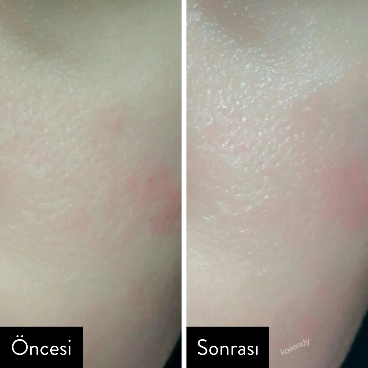 Klairs - Supple Preparation Facial Unscented Toner - Image 6