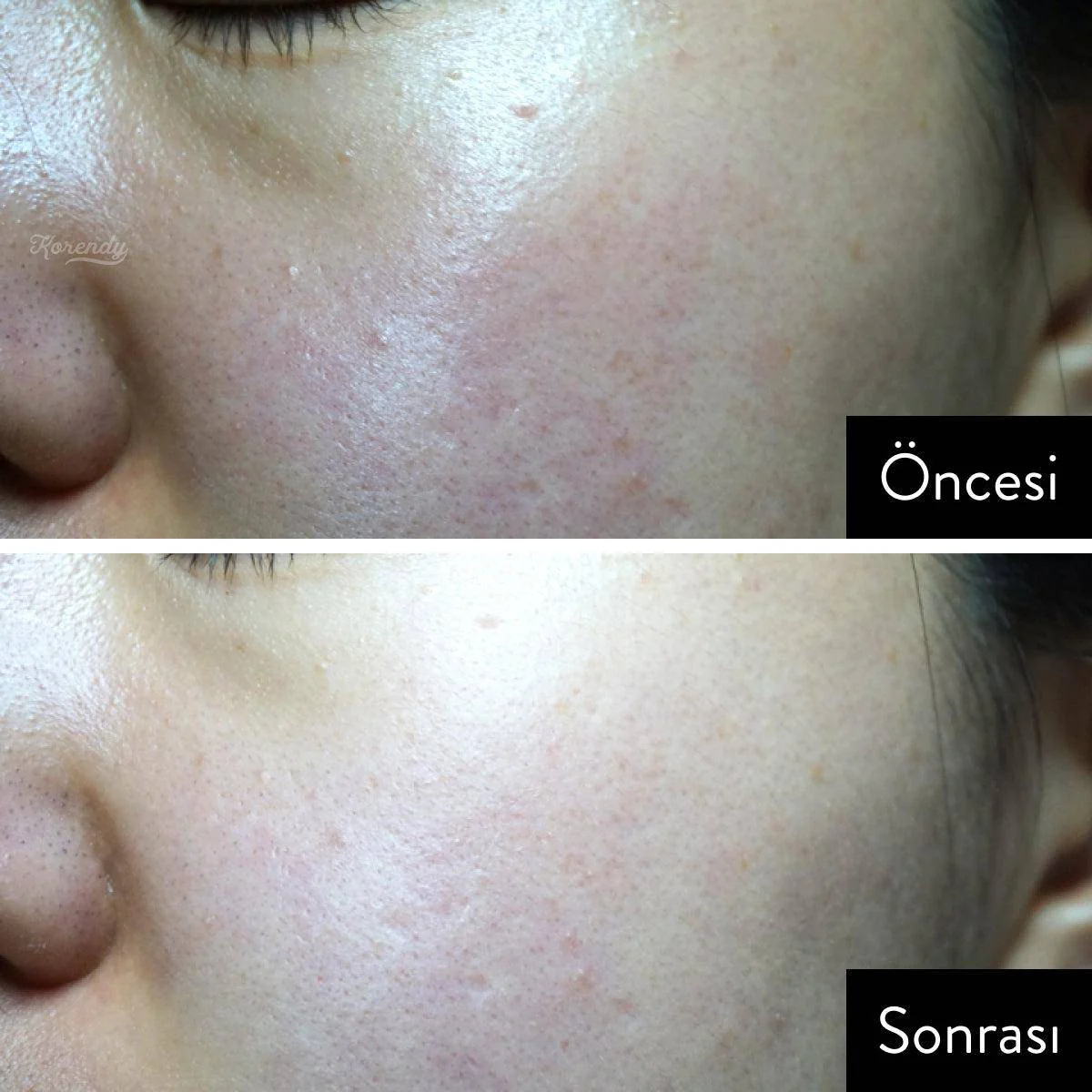 Moremo - Sun Stick SPF50+ PA++++ (Stik UV Güneş Koruyucu Krem) 16g (%45 İndirimli SKT: 2026-09-20) - Image 3