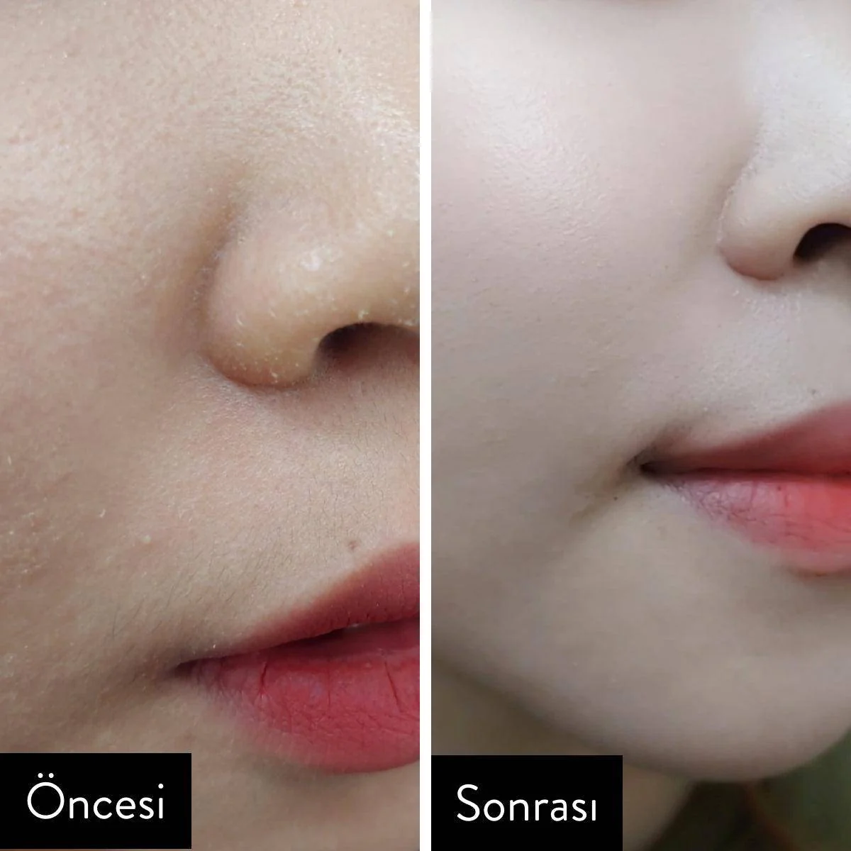 Some By Mi - AHA BHA PHA 30 Days Miracle Cream 60g - Image 4